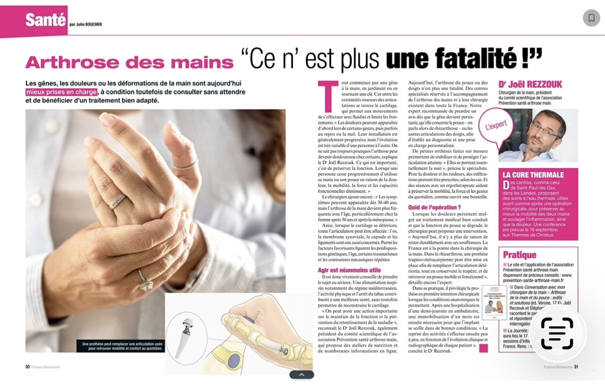 Article de France Dimanche : Arthrose des mains, ce n'est plus une fatalité